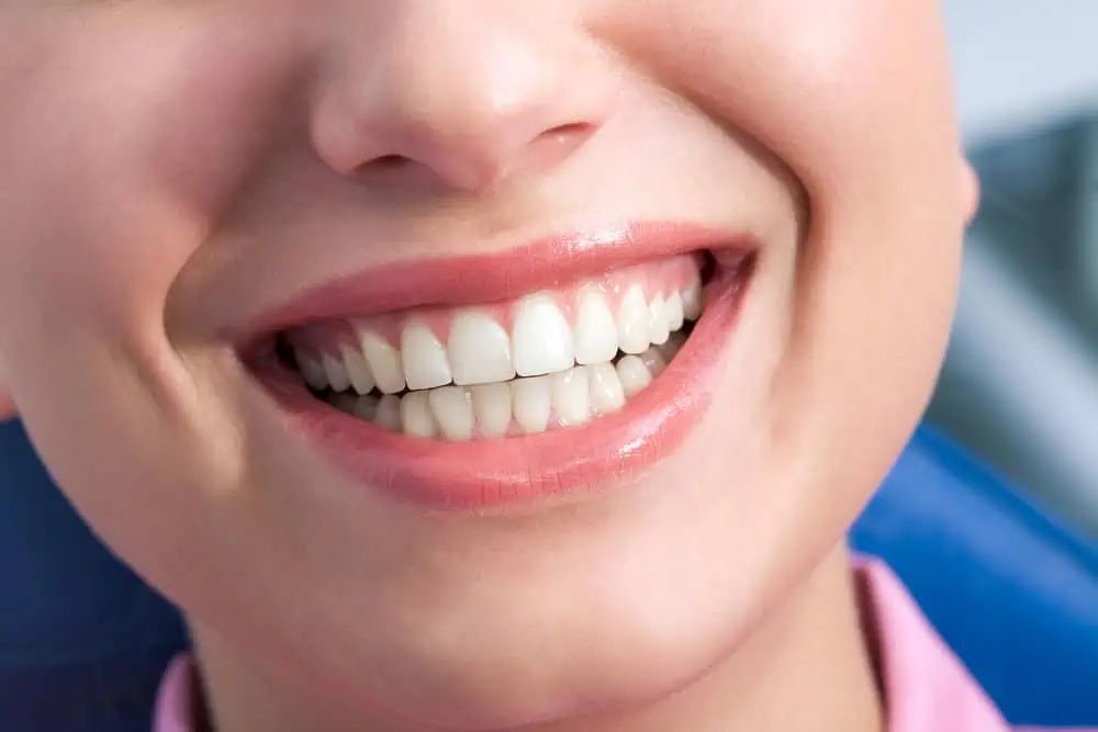 Dental Crowns 101: A Comprehensive Guide to Restoring Your Smile