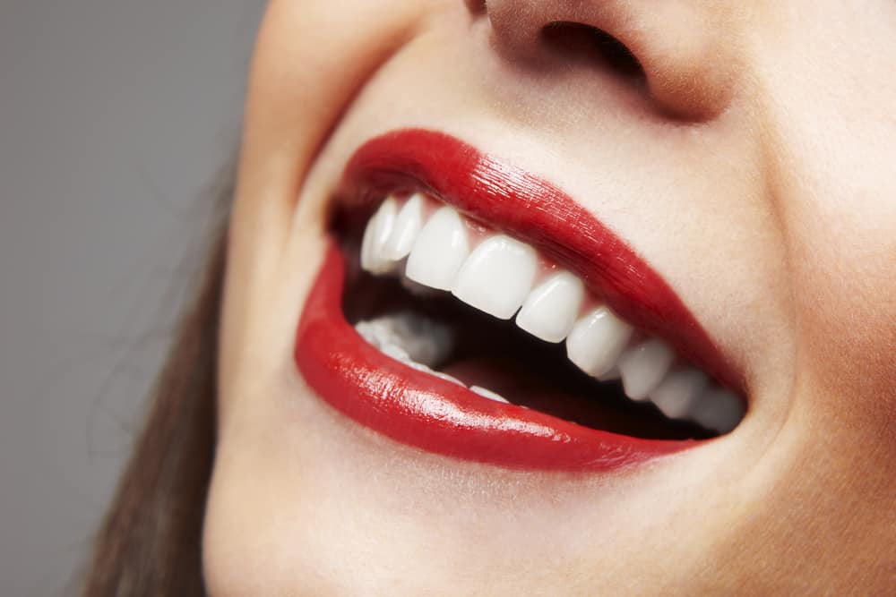 Seamless Smile Renewal: What Makes Dental Implant Bridges Unique